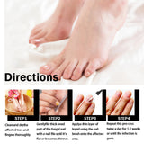 EELHOE Nail Repair Solution Thickening And Shining Nail Removal Dead Skin Repairing And Moisturizing Nail Nutritional Care Liquid